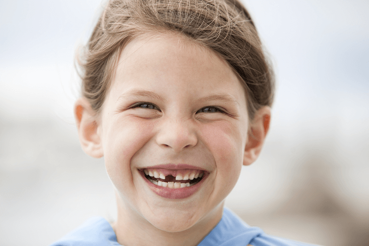 Missing Teeth Treatment Ottawa ON