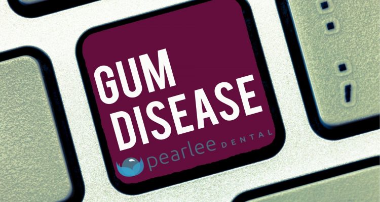 gum disease