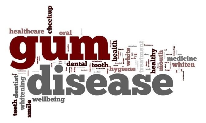 Gum disease word cloud